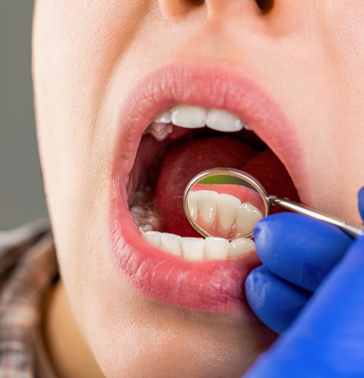 A Conservative, Personalized Approach