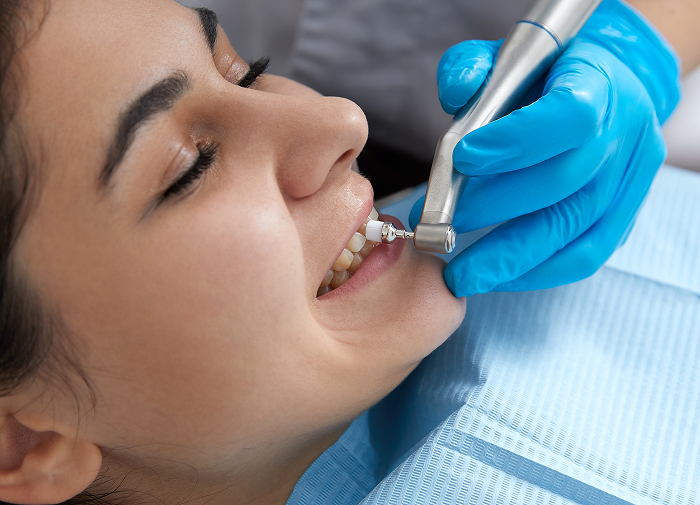 Professional Dental Cleanings