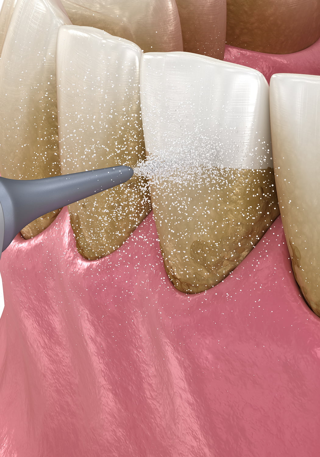 Dental Hygiene & Periodontal Care Banner Image