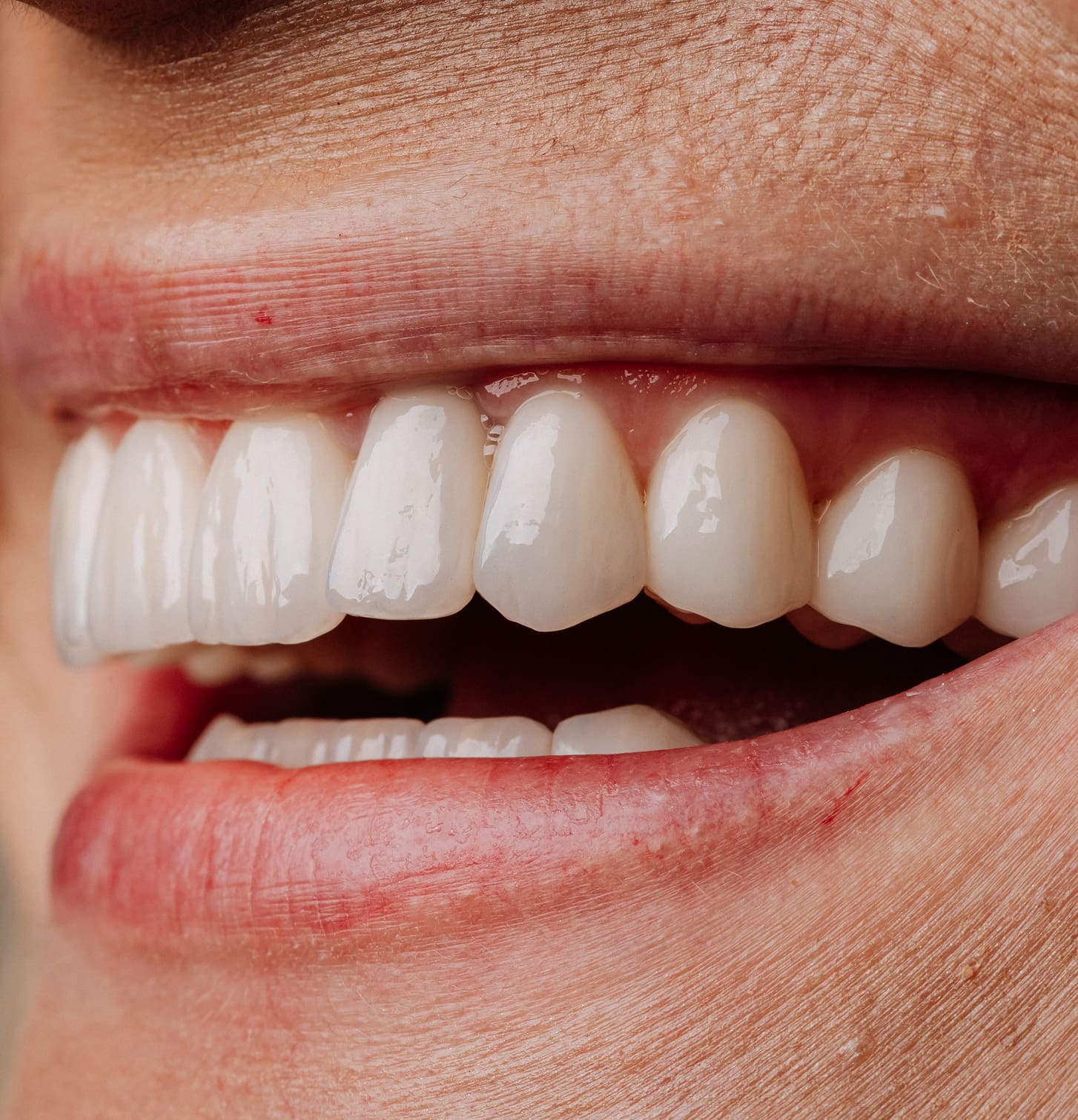 What Is Dental Hygiene and Periodontal Care?