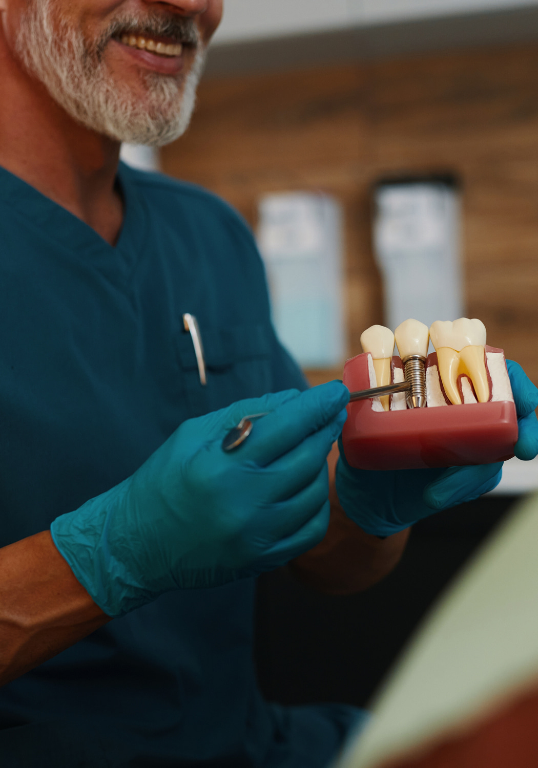 Dental Implant FAQs Banner Image