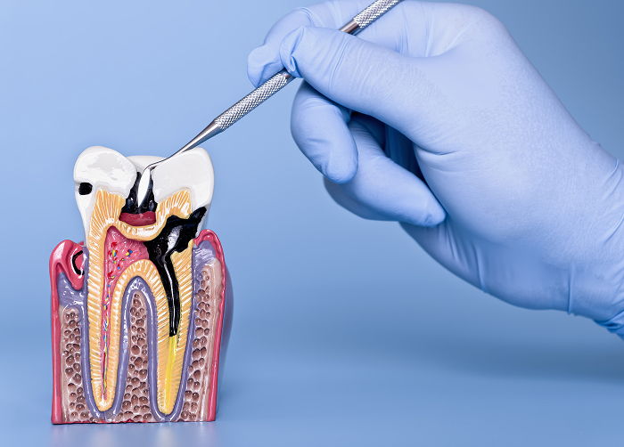 Repair of Damaged Teeth