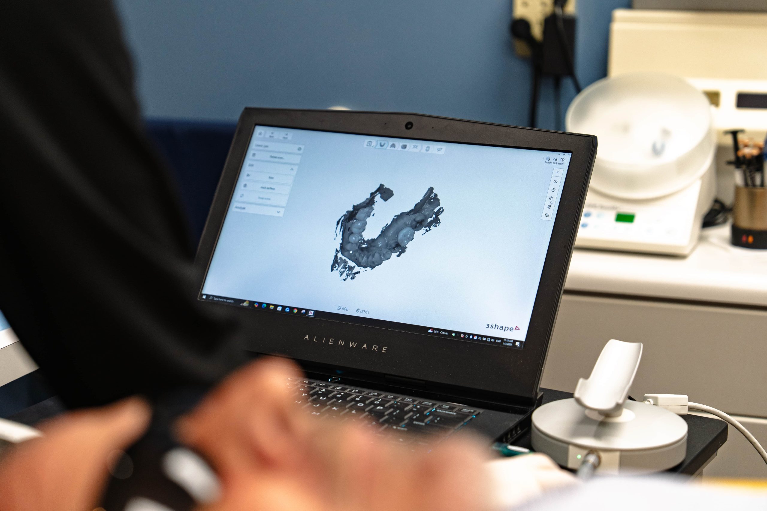 Invisalign treatment options