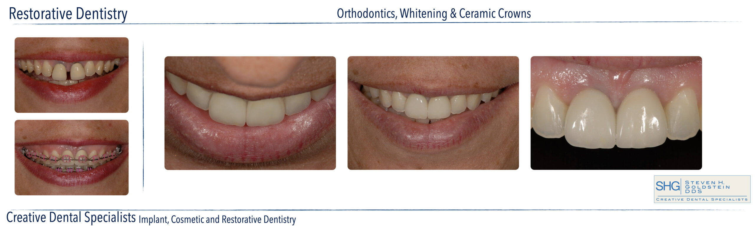 Restorative Dentistry