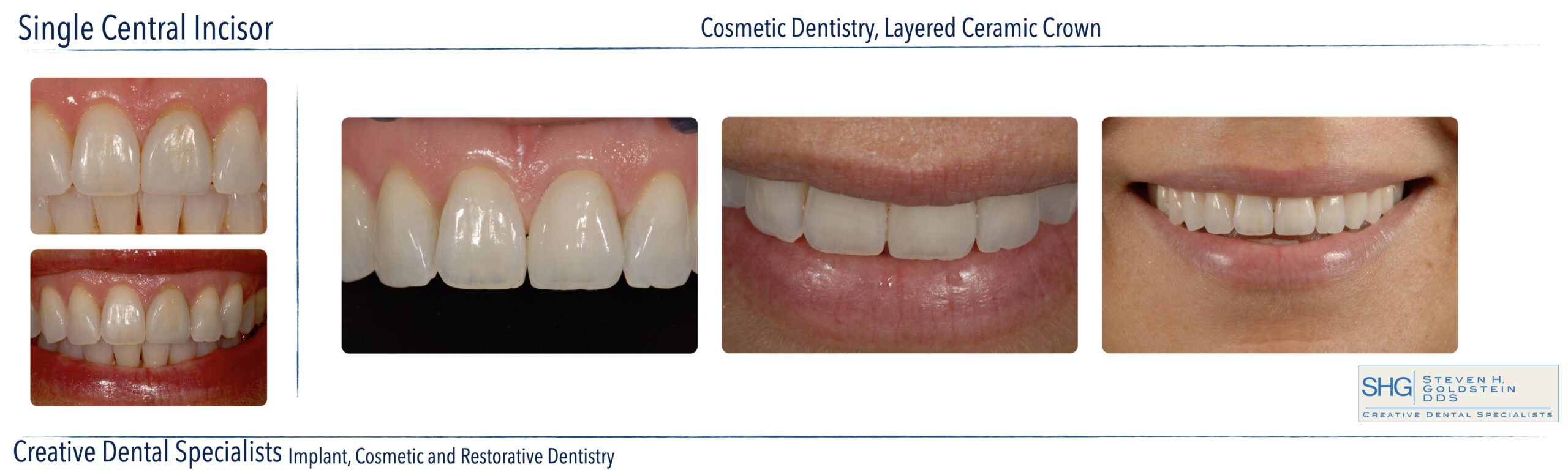 Cosmetic Dentistry