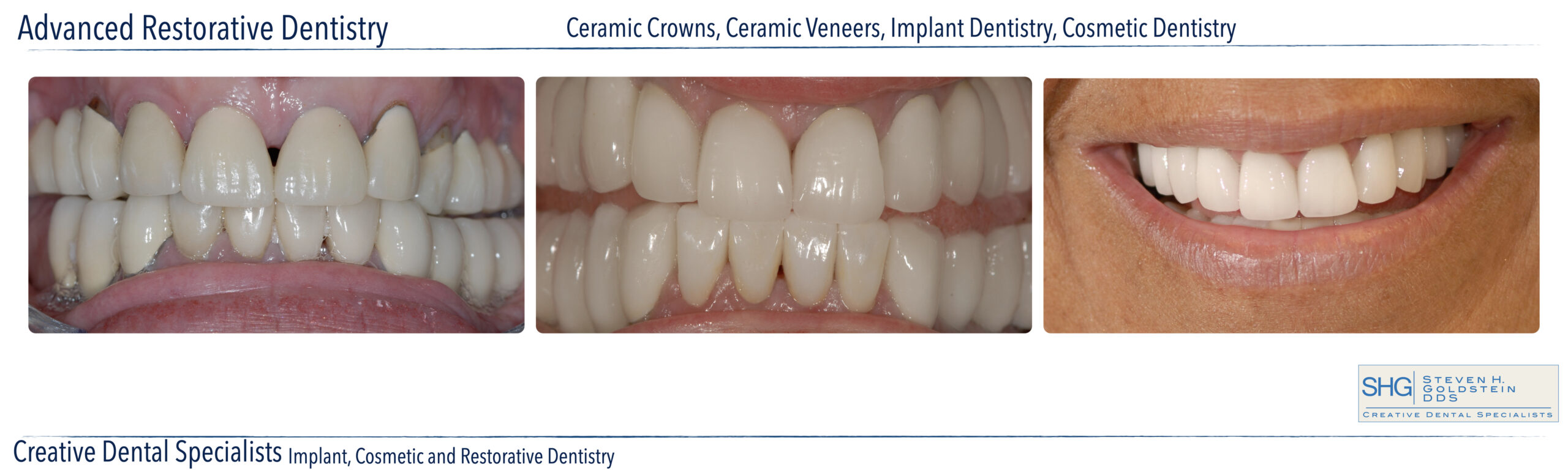 Advanced Restorative Dentistry