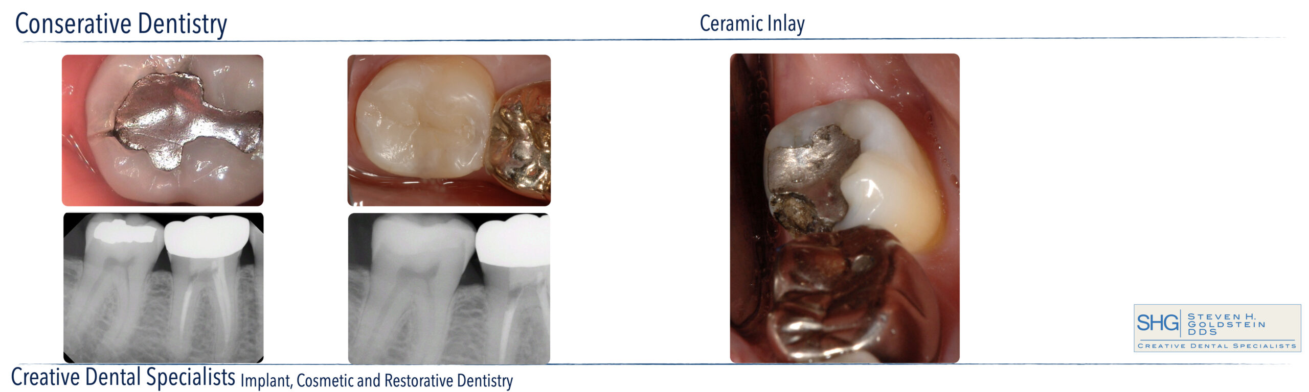 Conservative Dentistry
