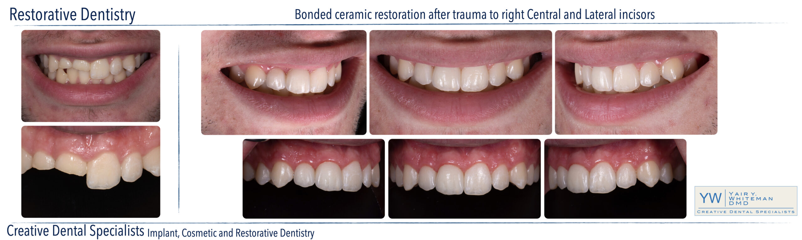 Restorative Dentistry