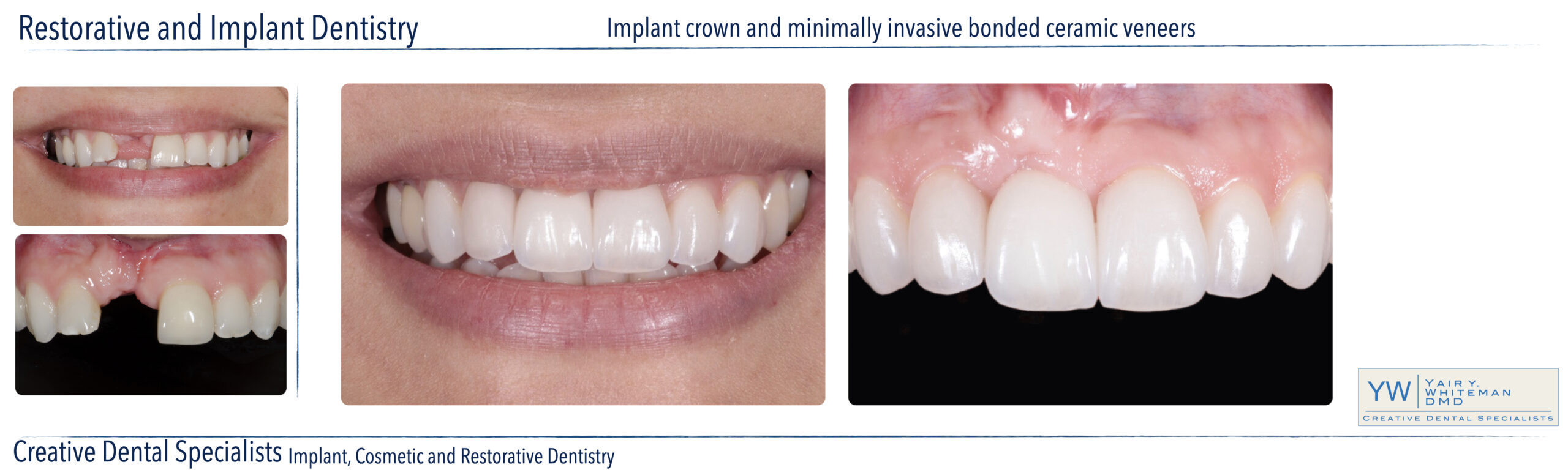 Restorative Dentistry