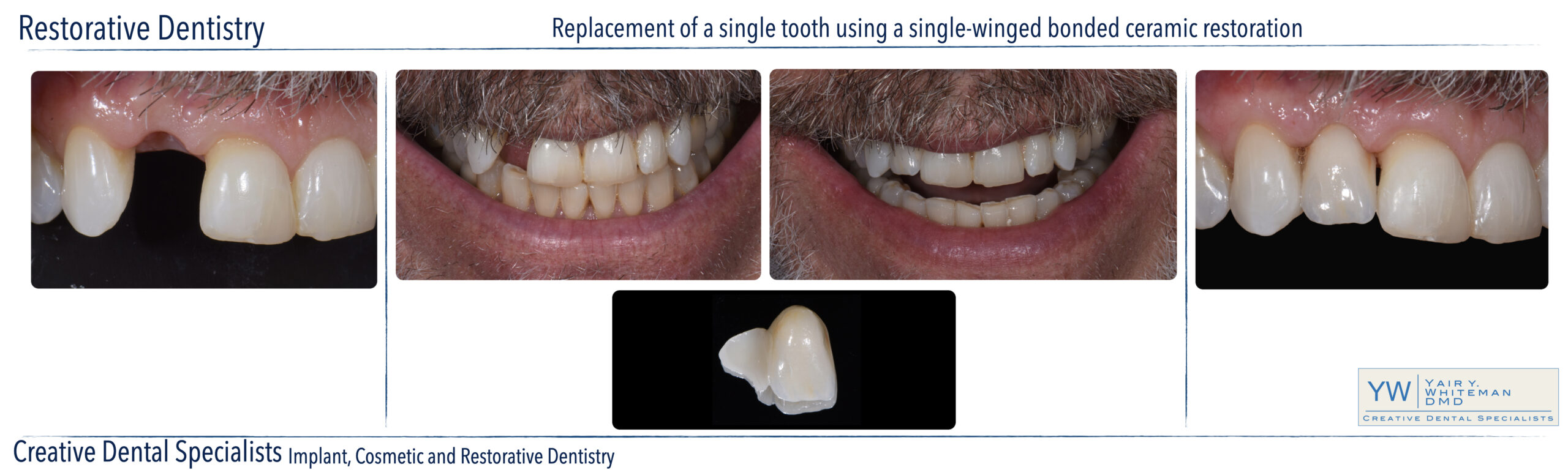 Restorative Dentistry
