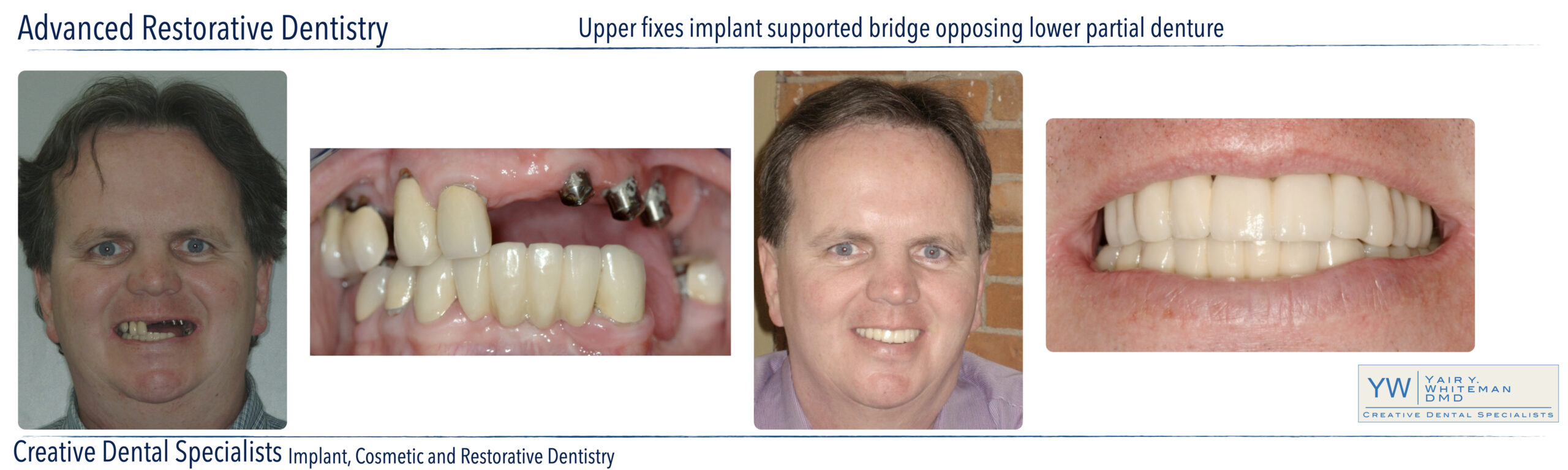 Advanced Restorative Dentistry