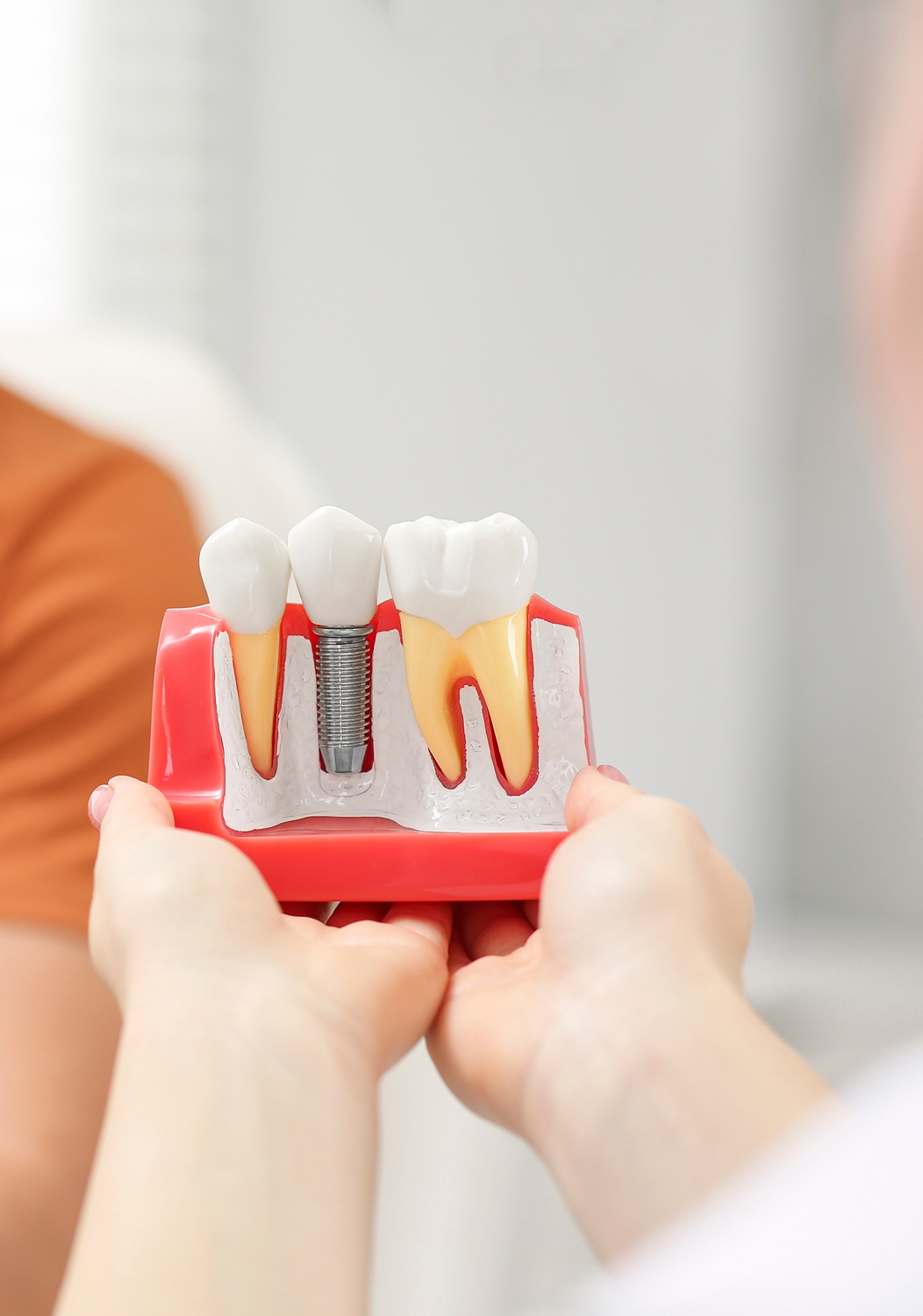 Implant Dentistry Banner Image