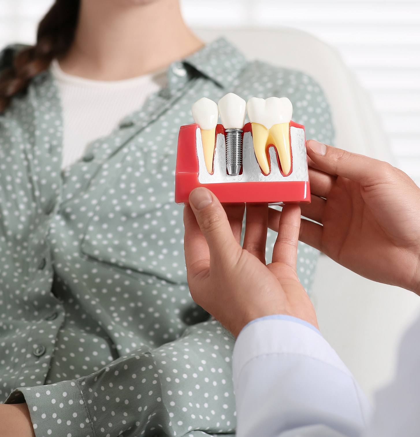 Benefits of Dental Implants