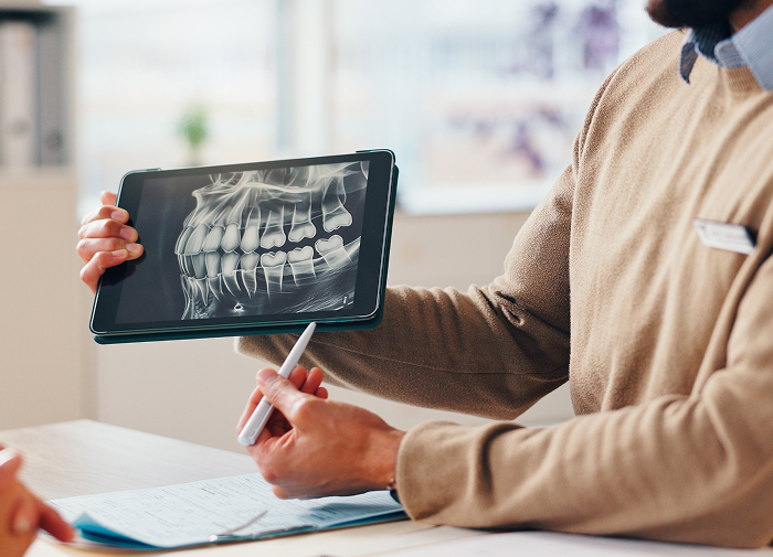 Comprehensive Implant Planning