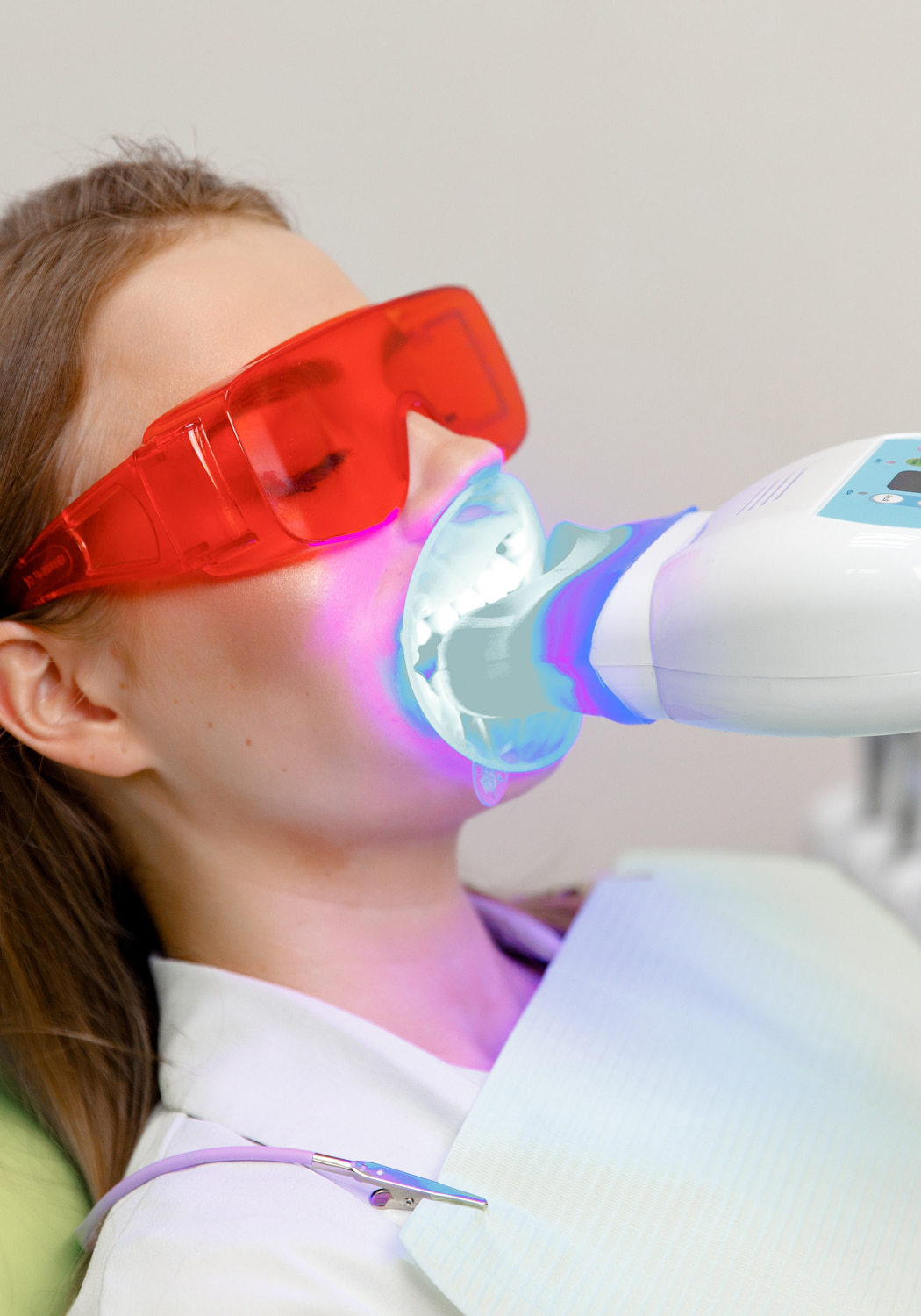 Teeth Whitening Banner Image