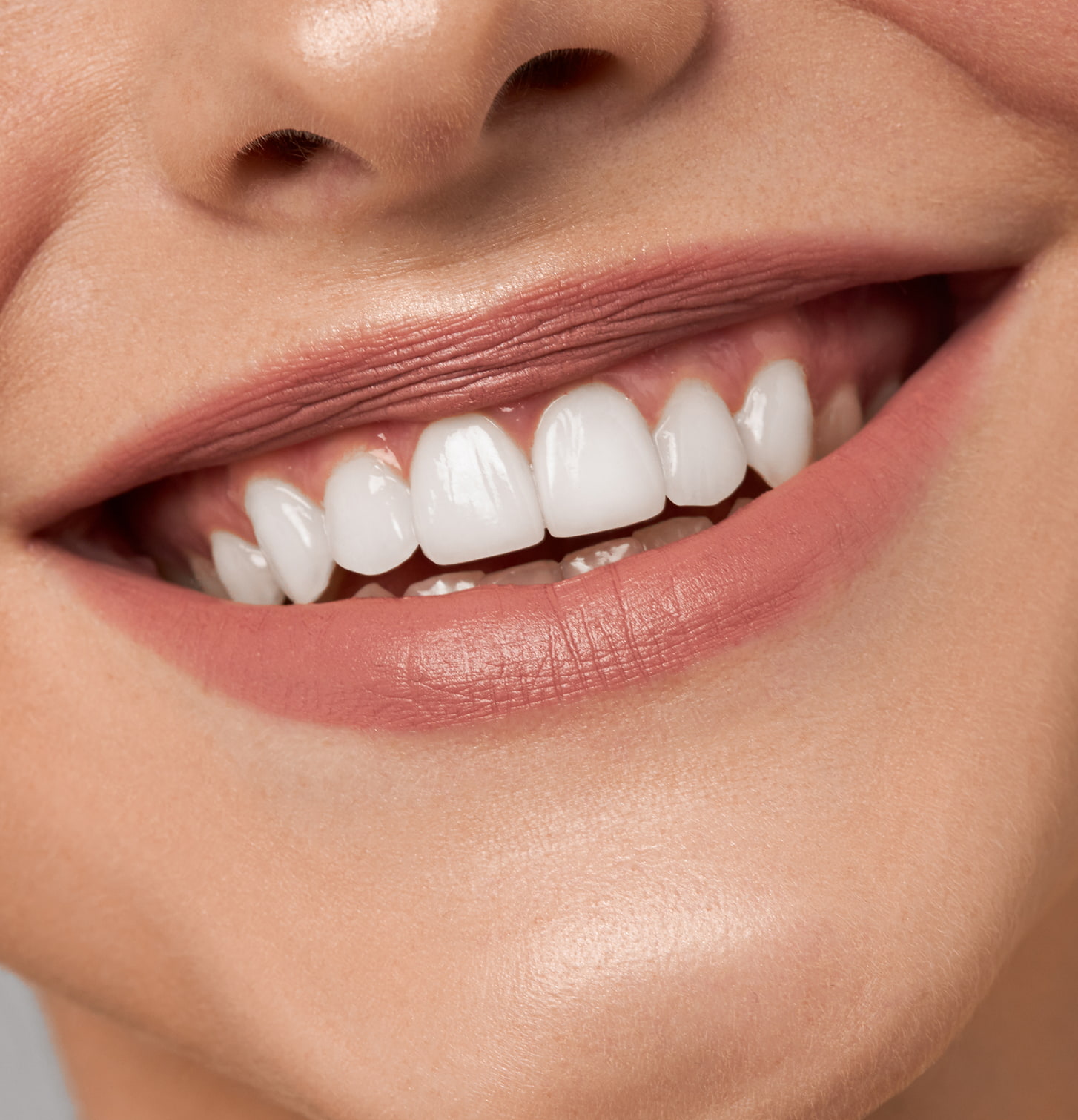 Benefits of Professional Teeth Whitening