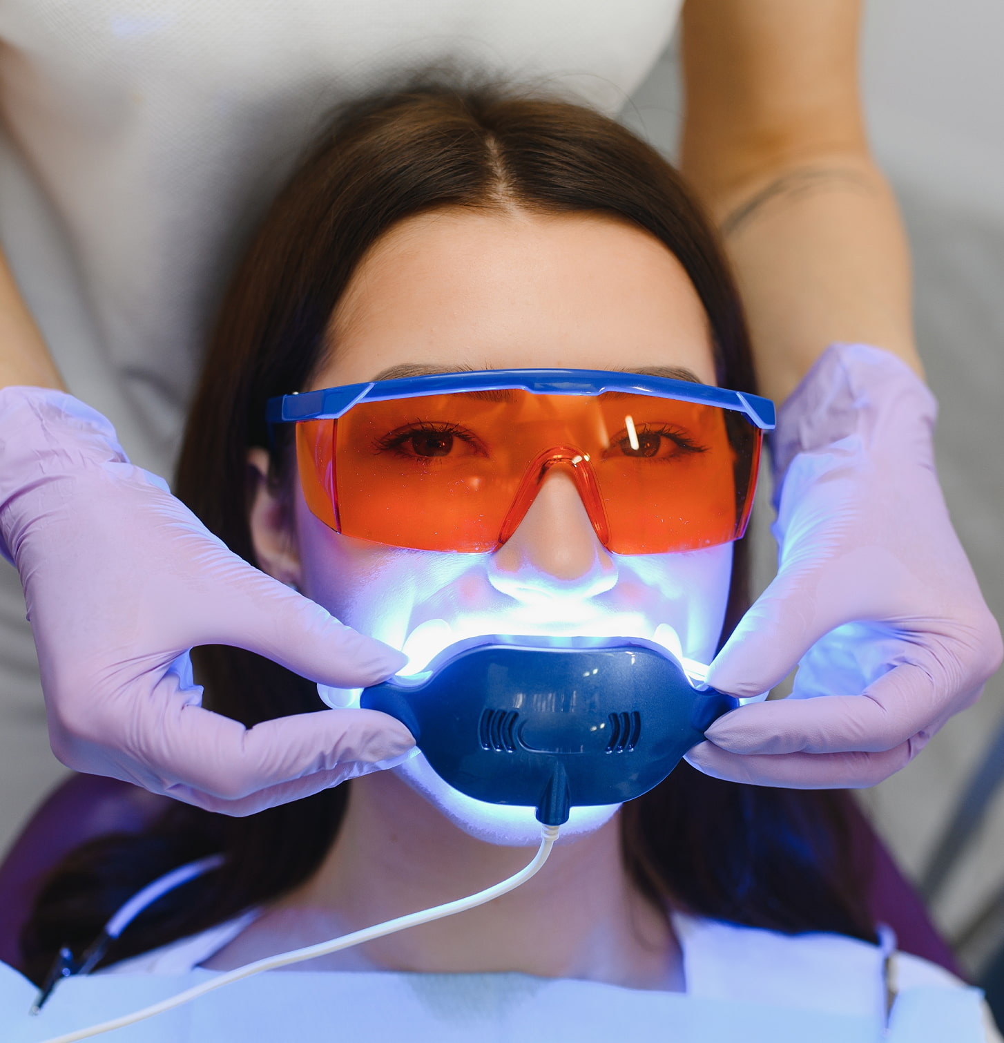 Maintaining Your Whitening Results