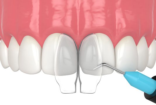 Cosmetic Dentistry